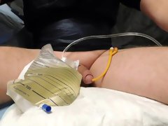 end of relaxation with catheter, removing catheter and pissing the rest